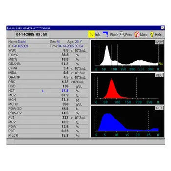 Open System Automatic Hematology Analyzer 3 Part Veterinary Blood Analyzer